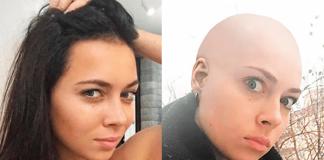 Nastasya Samburskaya is bald - why did the actress cut her hair, photo without hair, Instagram