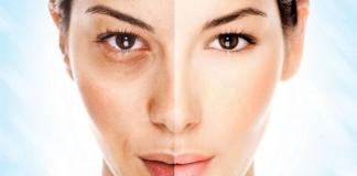How to quickly and effectively whiten facial skin at home